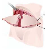 fat and skin removal