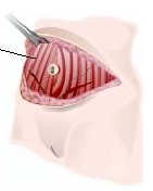 tightening muscles