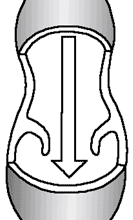 back flow of blood caused by a a faulty valve